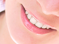 銀歯を白く替えることも可能です～銀歯とセラミックの比較～